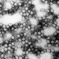 Yellow Fever Virus virions (234,000 X magnification)