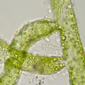 Chytrid - in situ on Vaucheria siphon - magnified
